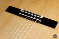 Dieter Müller - 2022 Doubletop Spruce 63 cm