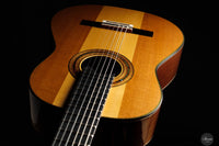 Jialan Chen - 2024 - Coclea Thucea “Fibonacci”