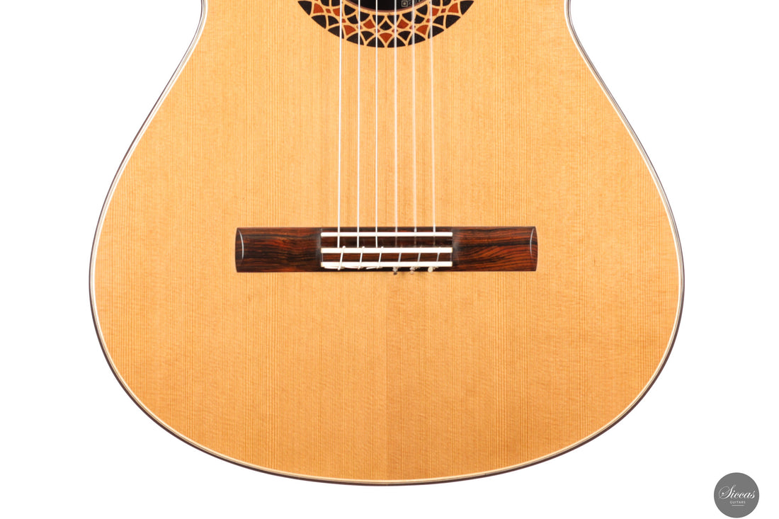 Julio Baarslag Espinosa - 2025 Doubletop