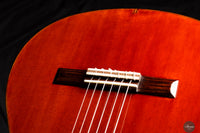 Saeid Aboutalebian - 2025 No. 62 Doubletop
