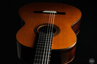 Carsten Kobs - 2026 Cedar Doubletop