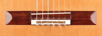 Dieter Müller - Doubletop 2011 63 cm