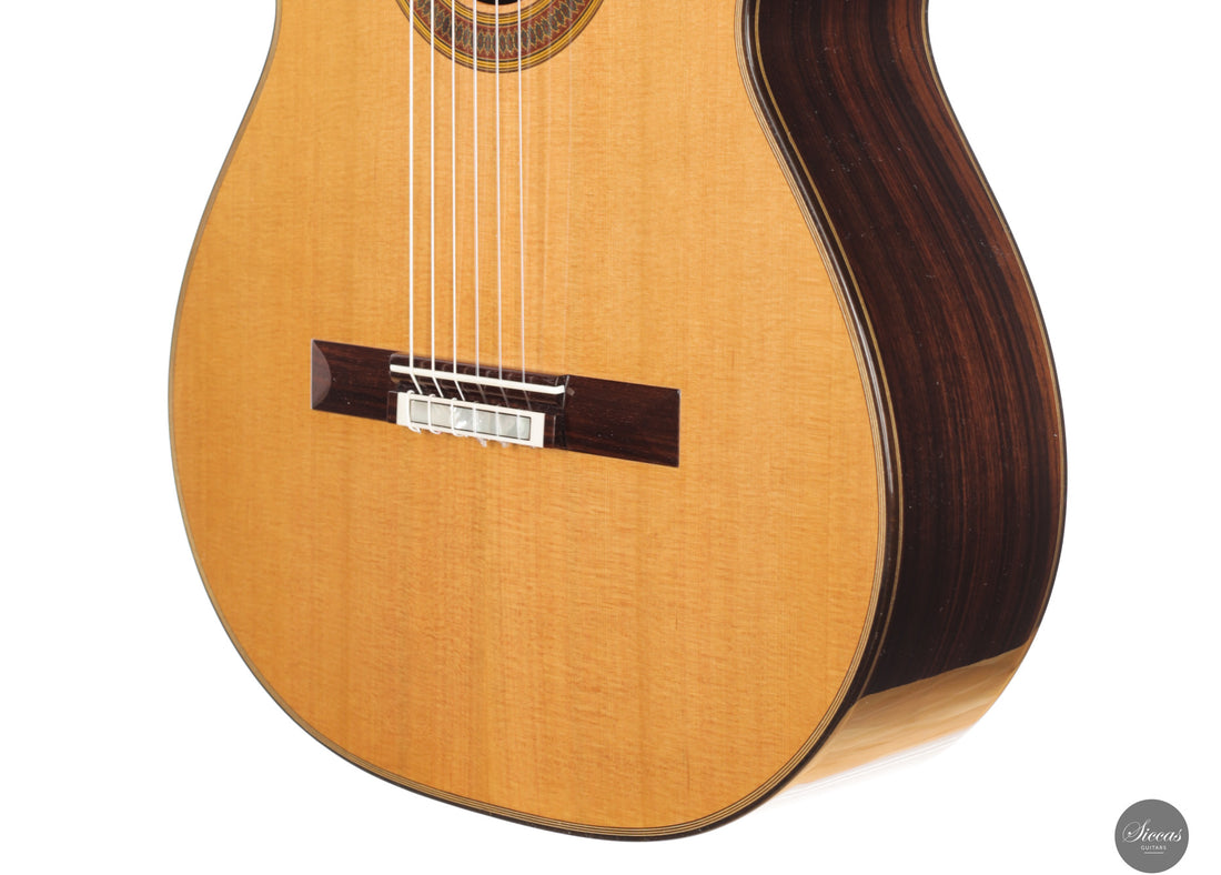 Siccas Luthiers - Synthesis Doubletop Cedar