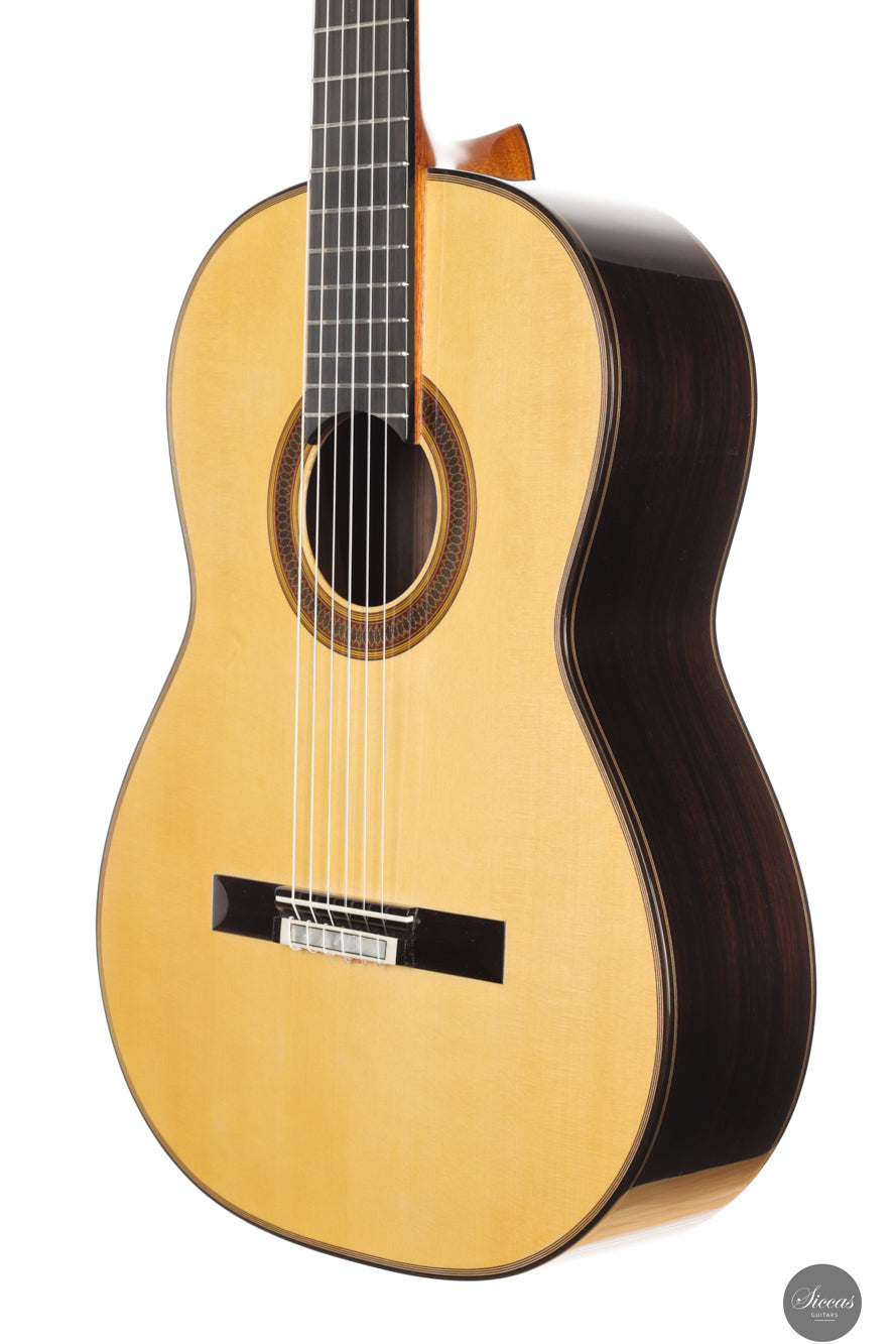 Siccas Luthiers - Synthesis Doubletop Spruce