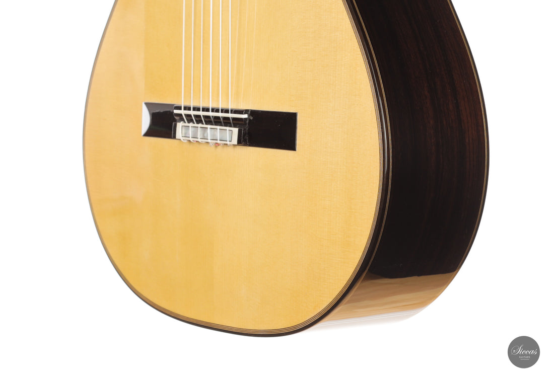 Siccas Luthiers - Synthesis Doubletop Spruce