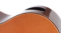 Yulong Guo - 2015 Doubletop